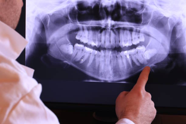Best Emergency Dental Care for Sports Injuries in Moosup, CT