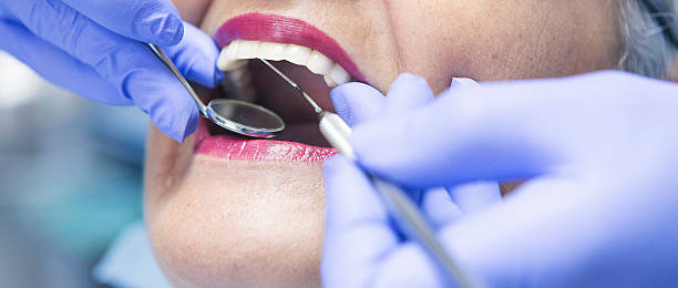 Best Emergency Cosmetic Dentistry (e.g., broken veneers) in Moosup, CT